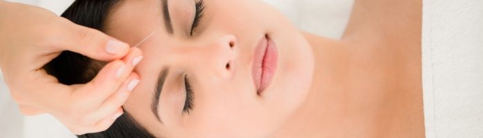 Akupunktura na ból głowy. Jakie są najczęstsze przyczyny bólu głowy według medycyny chińskiej? Kobieta poddaje się zabiegowi akupunktury w gabinecie.