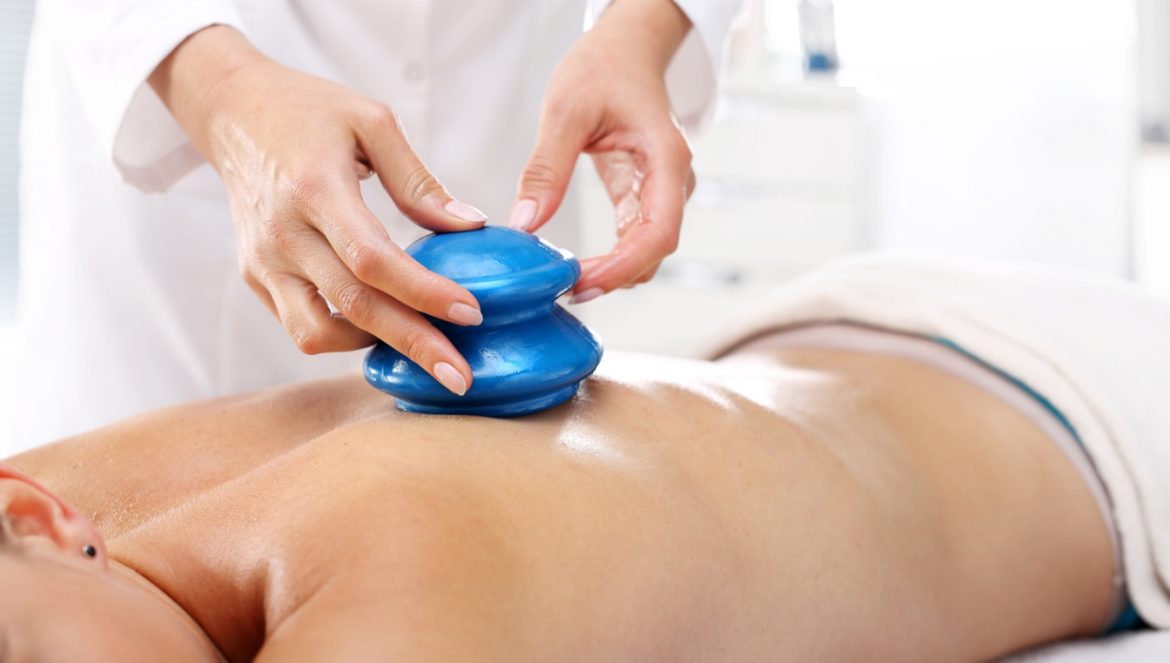 Masaż bańką chińską. Masażysta masuje plecy kobiety gumową bańką chińską.