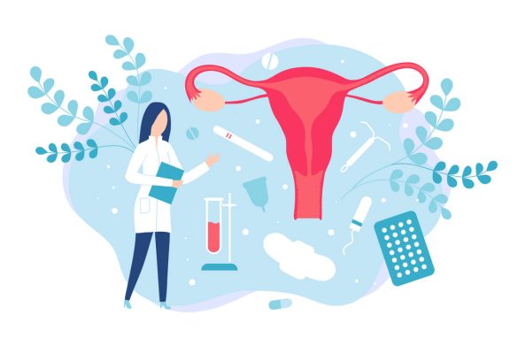 Endometrioza Objawy Przyczyny Leczenie Naturalnie O Zdrowiu 6032