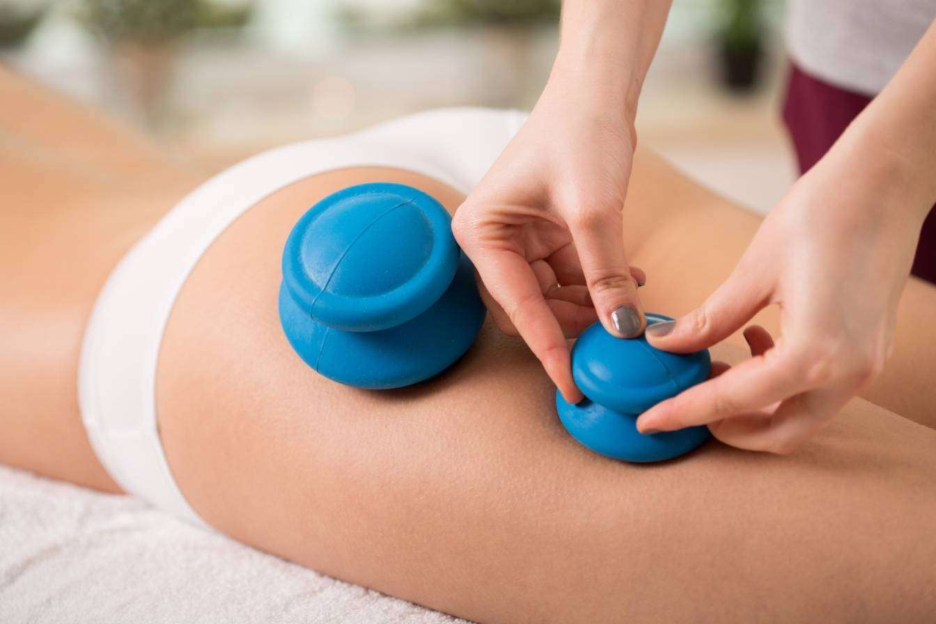 Masaż bańką chińską na cellulit - jak działa i w jaki sposób pomaga?Masażysta wykonuje zabieg na pośladki i uda.