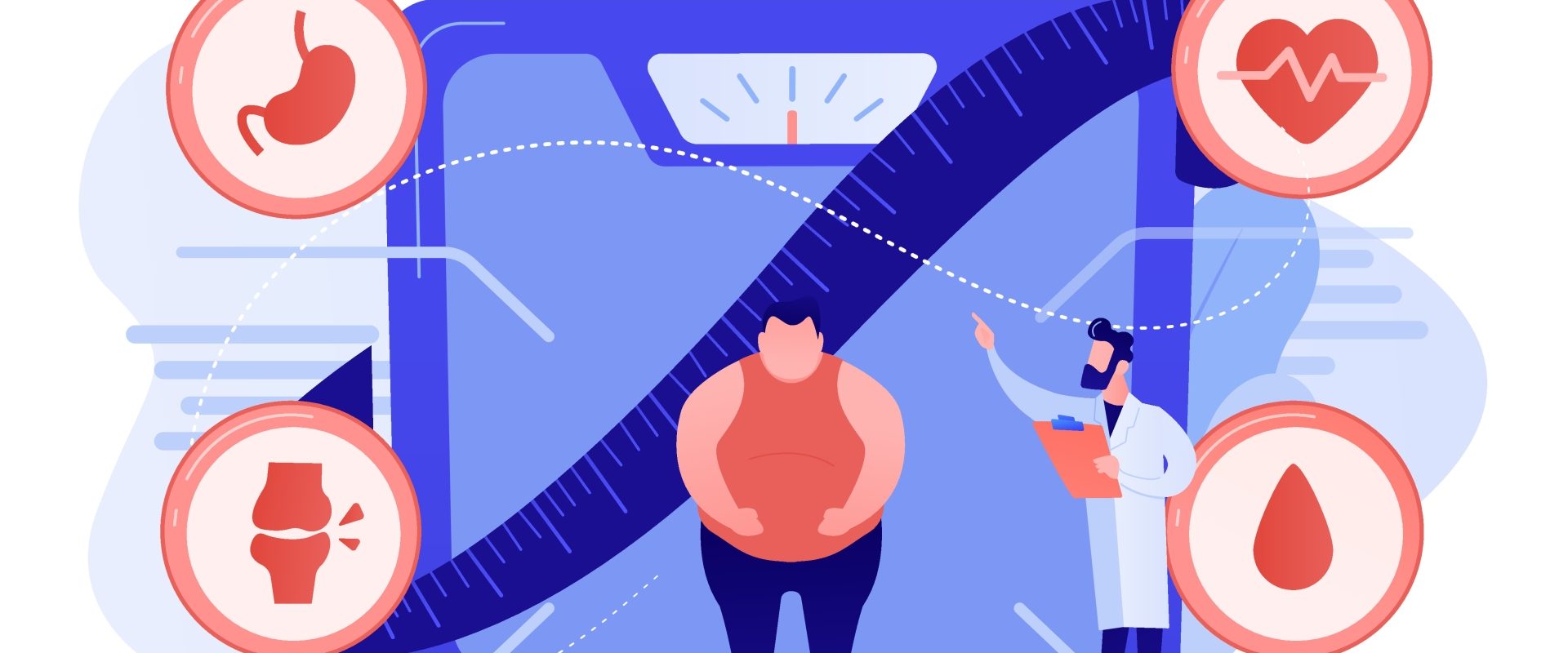 Otyłość brzuszna u mężczyzn - co oznacza i jak sobie z nią poradzić? Ilustracja przedstawiająca otyłego mężczyznę stojącego na wadze pod okiem lekarza.