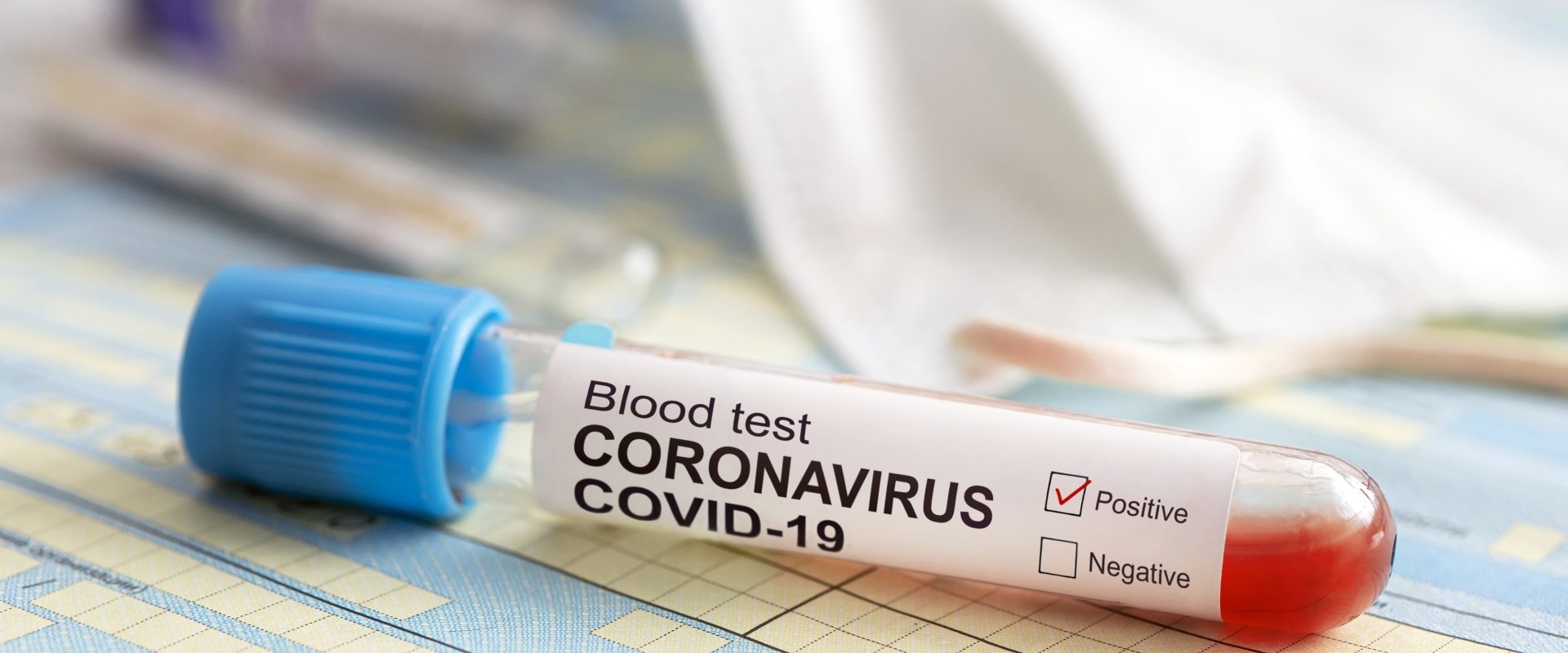 Test na koronawirusa - kiedy można go wykonać?