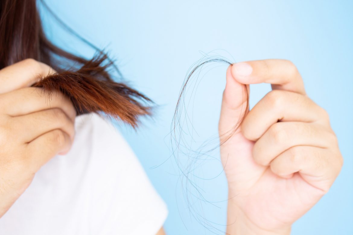 Wypadanie włosów po ciąży - jak temu przeciwdziałać? Kobieta trzyma w ręku garść włosów, które wypadły.